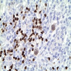 آنتی بادی CD138 برند NOVOCELL